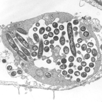 Legionella pneumophila in einem Lungenfibroblasten